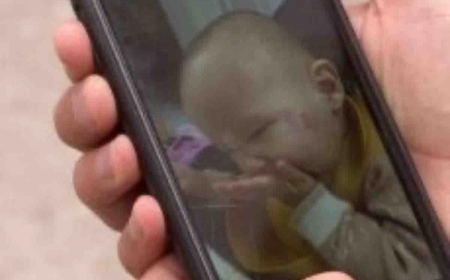 «Қансырап тұрды»: Шымкенттегі балабақшада 2 жасар қызды әлдекім тістелеп тастаған