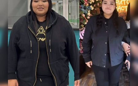 Асқазанына ота жасаған Айшолпан Тілеутай аз уақытта 40 келі салмақ тастаған