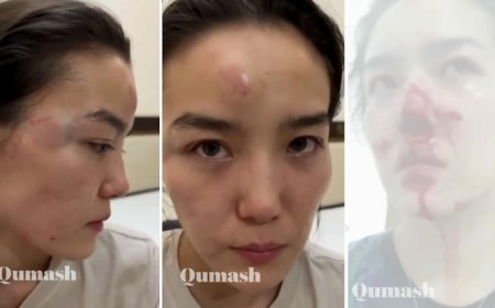 «Аузы-мұрны қанжоса»: Карина Мамаштың адам шошырлық ВИДЕО-сы тарады