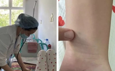 Қарақұрт шаққан: Атырауда екі бала жансақтау бөліміне түскен