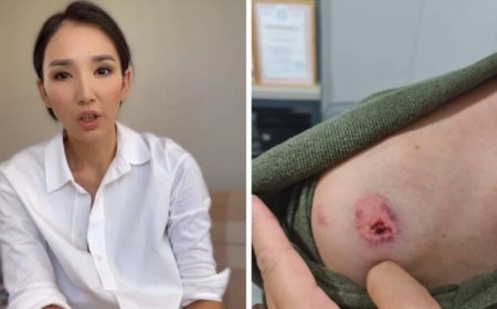 Марат Әйтеновты тістеп алған бұрынғы әйелі айыппұл төлейді