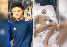 Ұлттық ұлан: Мұхтар Ербаян пневмония мен гаймориттің кесірінен осындай күйге душар болды