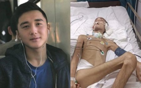 «Аяққа тұрып кетуіне 80 пайыз кепілдік бар»: Әскерде комаға түскен Ербаян Мұхтарды ата-анасы Германияда емдетпек