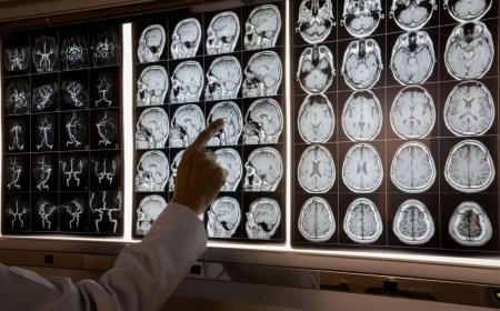 «Адамдардың миы шіріп жатыр» – Нейробиолог