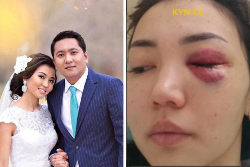 Презервативте сперматозоидты қалай сақтауға болады Үлкен мүшесі бар порно трансни