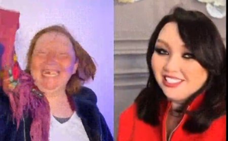 «25 жыл бойы тіссіз жүрген»: Адам танымастай өзгерген әйел желідегілерді тәнті етті