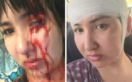 «120 келі салмағымен үстіме отырып алды». Атырау тұрғыны депутат күйеуінің қорлығынан кейін жүре алмай қалғанын айтты