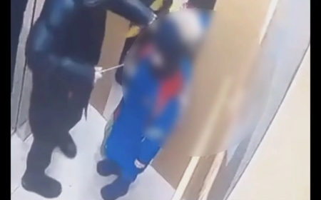 Астанада белгісіз біреу лифт ішінде 5 жасар баланың бетін пышақтап тастады