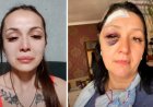 «Анамды темір сойылмен ұрды»: Алматы тұрғыны халықтан көмек сұрады (ВИДЕО)