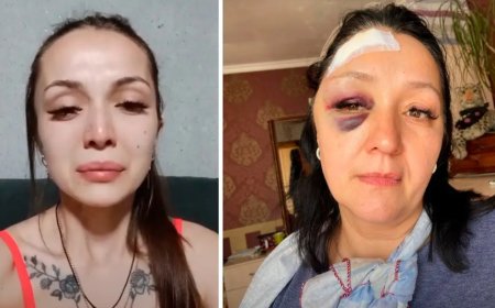 «Анамды темір сойылмен ұрды»: Алматы тұрғыны халықтан көмек сұрады (ВИДЕО)