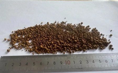 Алматы дәрігерлері қырық жастағы адамның өтінен 5500 тас алып шыққан