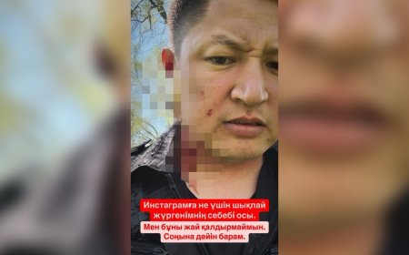 «Мұны жай қалдырмаймын»: Нұрболхан Шараповтың қан-жоса болған суреті тарады