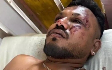 «Есімді жиғанда айналамда мәйіттер жатты»: 242 жолаушысы бар ұшақ апатынан бір адам ғана тірі қалды