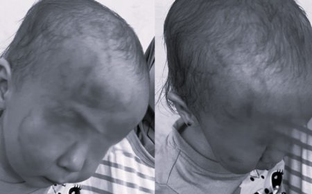 «40 минут бойы тістеген»: Ақтаудағы жекеменшік балабақшада сұмдық жағдай тіркелді