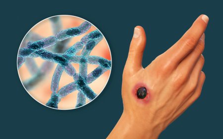 Шымкентте үш адамнан күйдіргі анықталды