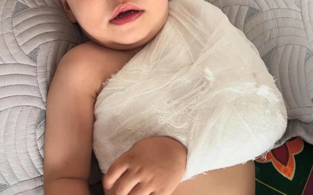 13 жасар жеткіншек бүлдіршіннің қолын сындырды: Зәкиева түсініктеме берді