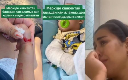 «Меркі ауруханасына барсаң, тірі шықпайсың: қан алмақ болған дәрігерлер баланың қолын сындырып жіберген
