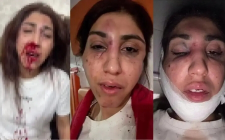 Алматыда экс-әйелінің жағын сындырып, өзін өлімші етіп сабаған еркек қамауға алынды