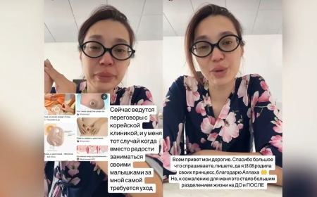 Ақтөбе дәрігерлері егіз қыз босанған келіншектің жатыры мен қуығын бірге тігіп жіберген