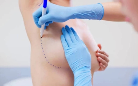 Енді жасанды төс жасатқандар абақтыға қамалады