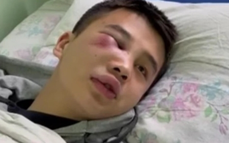 Алматыда 18 жастағы жігітті бір топ адам аяусыз ұрып-соққан