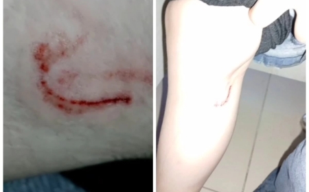 Көкшетауда 15 жастағы қызды иттер талап тастады (видео)