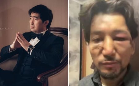 Мұқасан Шахзадаев соққыға жыққан әншінің жағдайы ауыр (ФОТО)