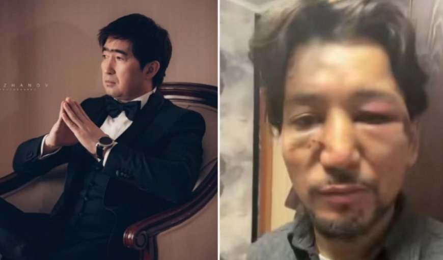 Мұқасан Шахзадаев соққыға жыққан әншінің жағдайы ауыр (ФОТО)