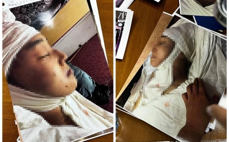 «Екеуі 30 минут төбелескен»: Ақнәр Гүлстанның өліміне қатысты жантүршігерлік дерек шықты