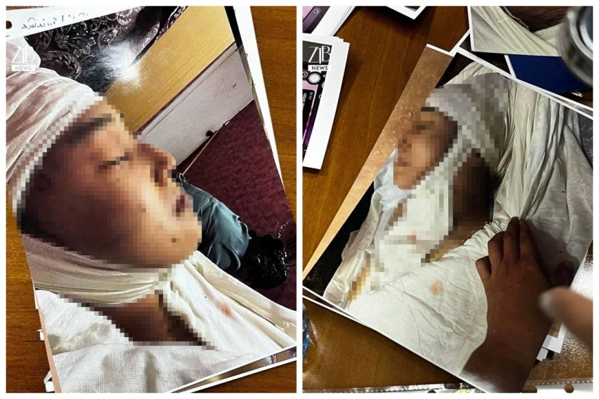 «Екеуі 30 минут төбелескен»: Ақнәр Гүлстанның өліміне қатысты жантүршігерлік дерек шықты