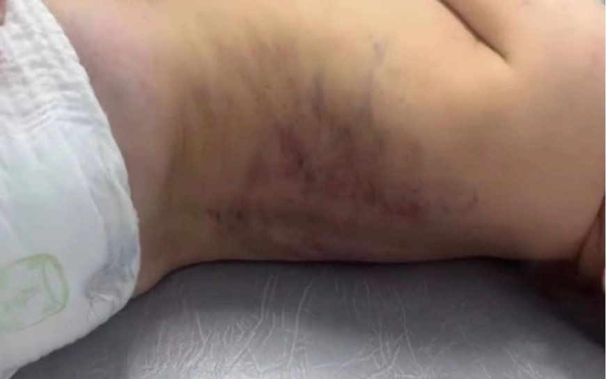 Жетісу облысында ер адам үш жасар баласын аяусыз ұрып-соққан