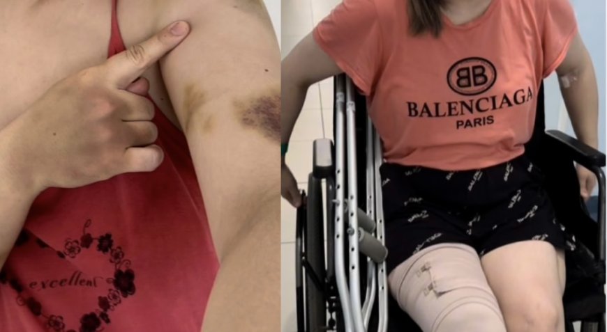 Ақтөбеде шенеунік бұрынғы әйелін аяусыз ұрып-соғып келген