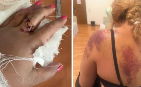 Жетісу облысында ер адам әйелді күрекпен аяусыз соққыға жықты