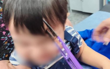 Алматыда бүлдіршіннің басына қайшы кіріп кеткен