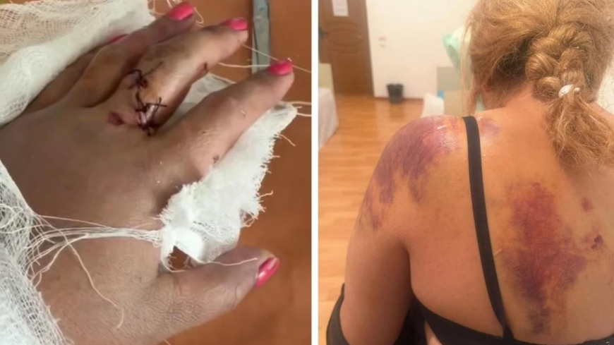 Жетісу облысында ер адам әйелді күрекпен аяусыз соққыға жықты