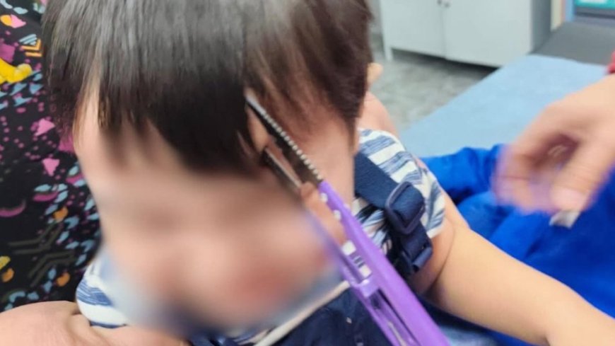 Алматыда бүлдіршіннің басына қайшы кіріп кеткен