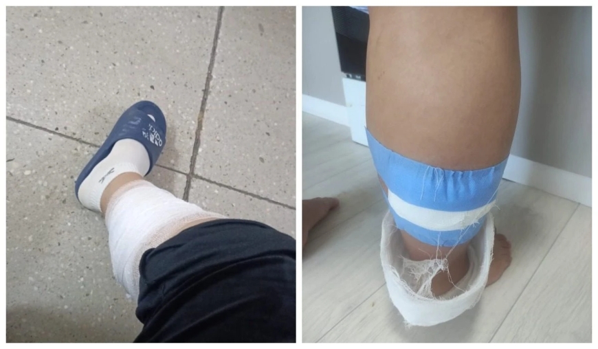 «Онға жуық ит жүрді»: Көкшетауда бұралқы иттер жүкті әйелге шабуыл жасаған