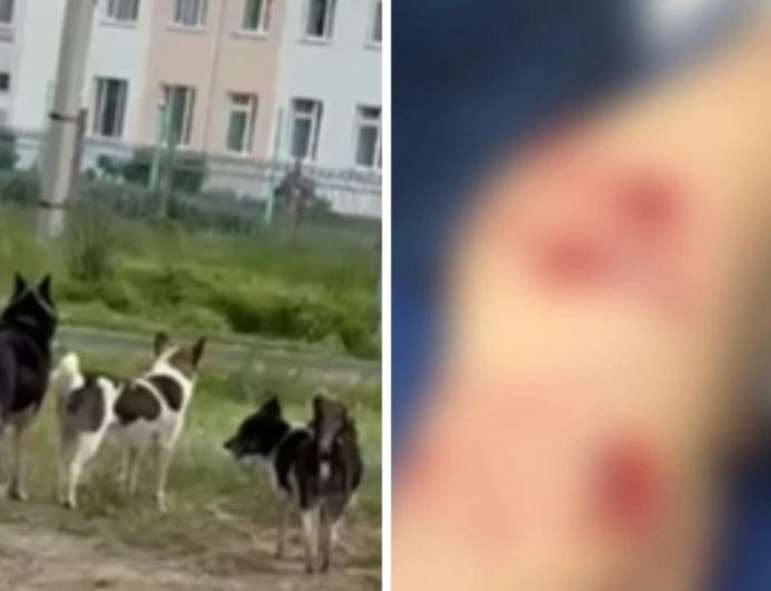 Оралда бұралқы иттер кішкентай баланы талап тастаған