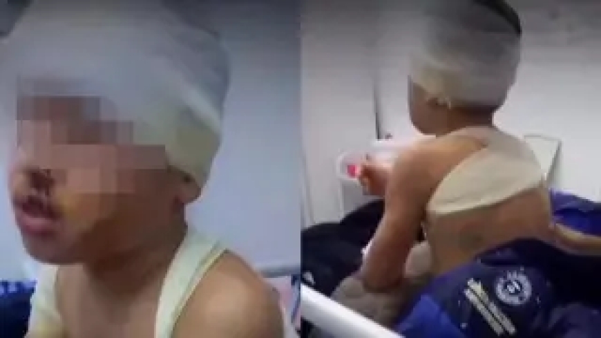 «Денесін үтікпен, ернін шанышқымен күйдірген»: Шымкентте балаларын  қорлаған анаға үкім шықты
