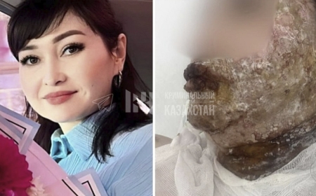 Шымкент тұрғыны экс-әйелінің бетін қышқыл сұйықтықпен күйдіріп тастаған (ВИДЕО)