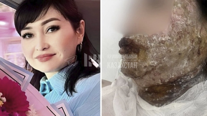 Шымкент тұрғыны экс-әйелінің бетін қышқыл сұйықтықпен күйдіріп тастаған (ВИДЕО)