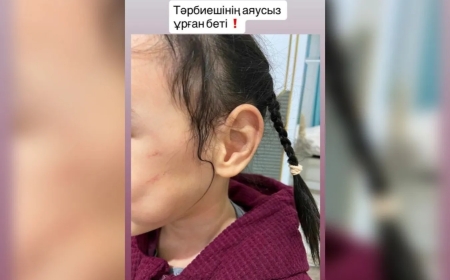 Астаналық әйел қызын балабақша қызметкері ұрып-соқты деп айыптады