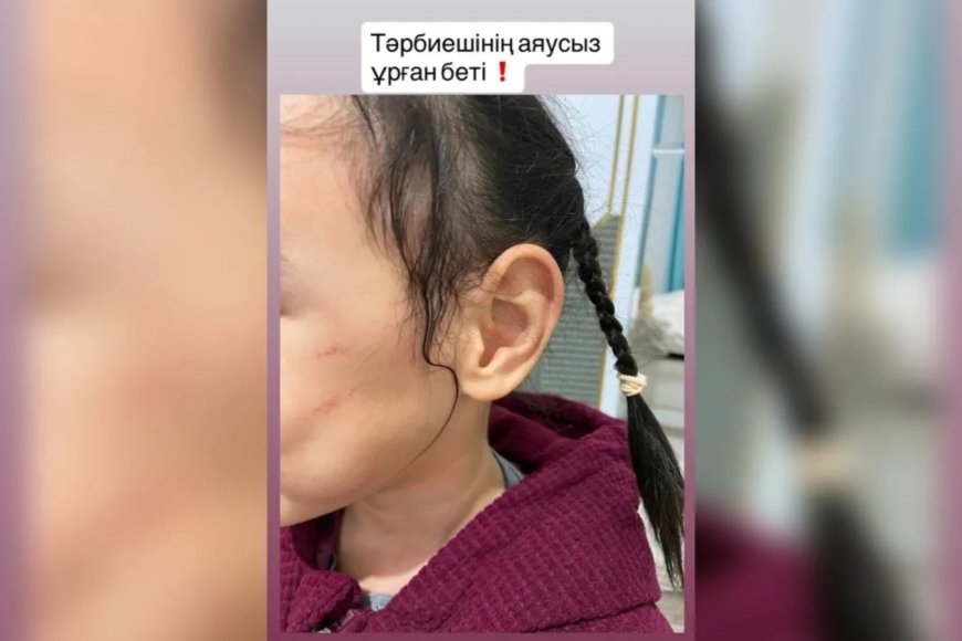 Астаналық әйел қызын балабақша қызметкері ұрып-соқты деп айыптады