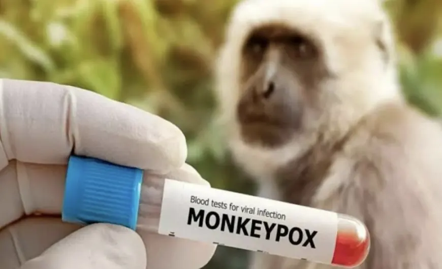 Министрлік маймыл шешегіне қатысты шұғыл мәлімдеме жасады